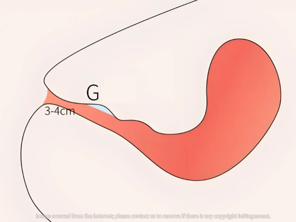 Stimulation of multiple points in the clitoris G spot and vagina can produce a very intense pleasure Clitoris × Point G × Vagin : La vérité sur les trois systèmes orgasmiques féminins